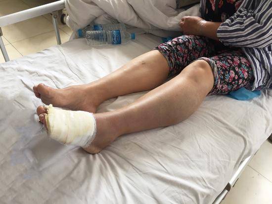 新澳今天晚上9点30分开门吗香港和女子遭毒蛇咬伤身亡与女子遭毒蛇咬伤身亡视频